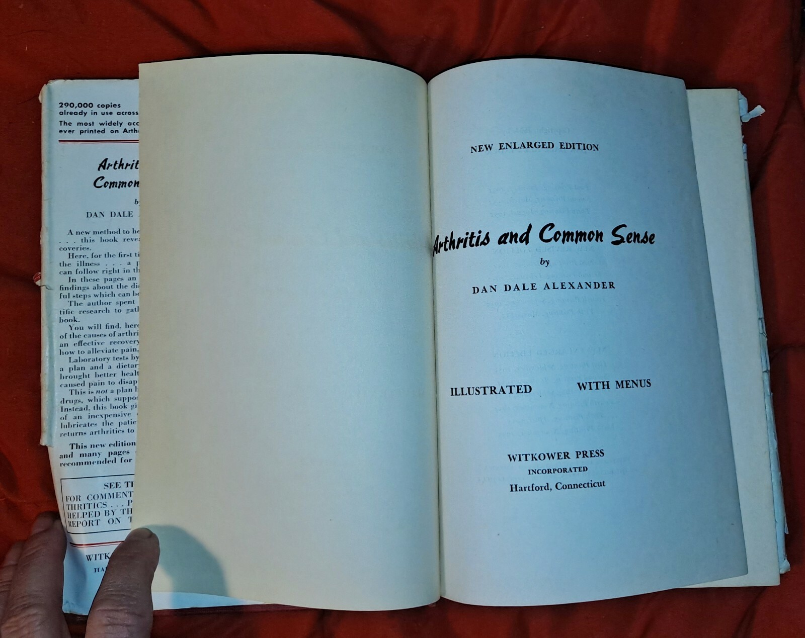 Arthritis & Common Sense by Dan Dale Alexander, 1955, includes menus, 255 pages