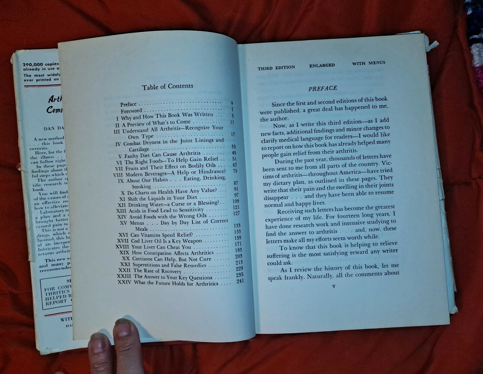 Arthritis & Common Sense by Dan Dale Alexander, 1955, includes menus, 255 pages